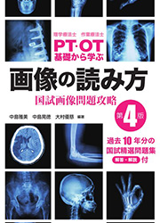 PT・OT基礎から学ぶ 画像の読み方 第4版